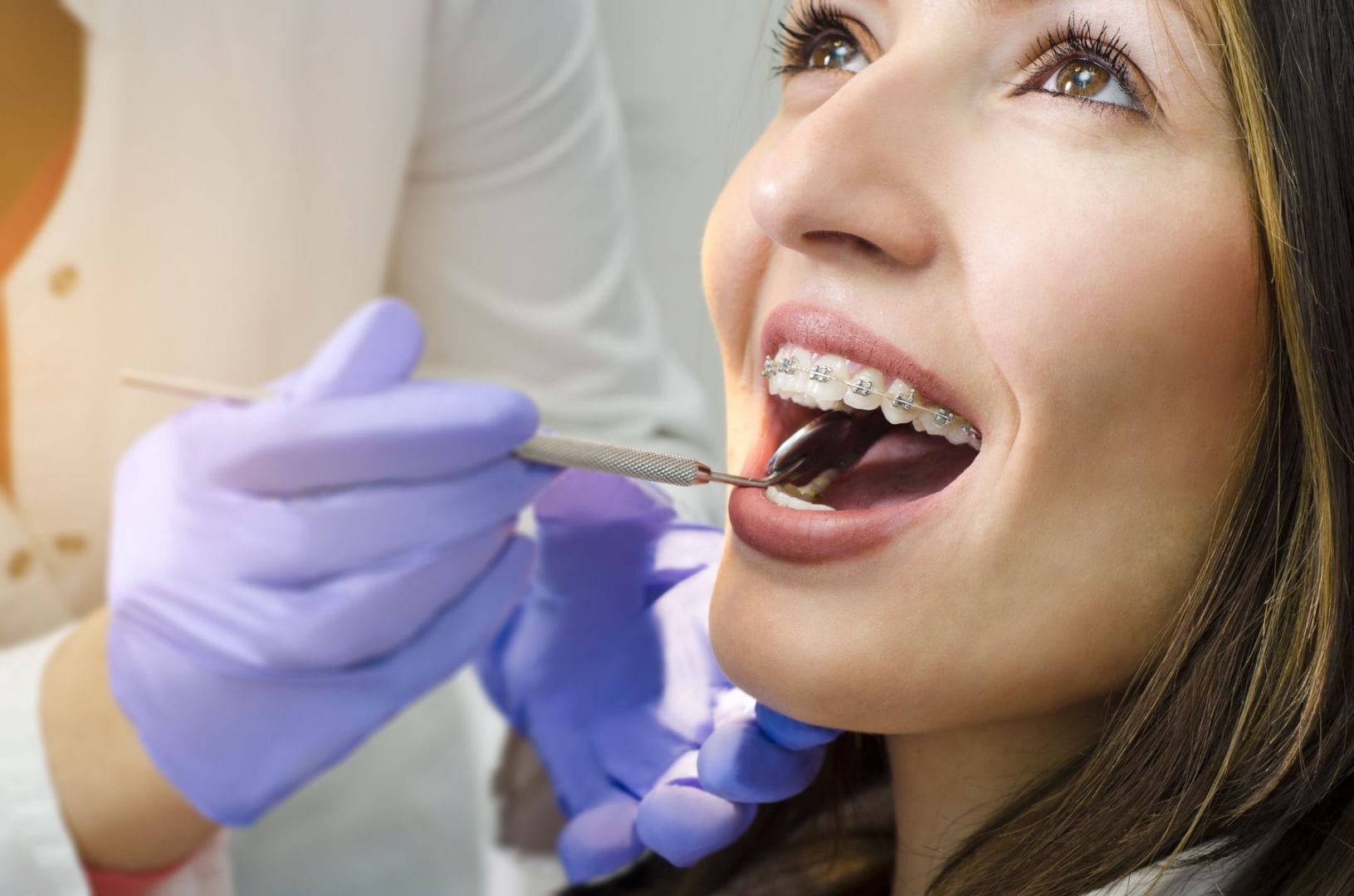 Ortodonzia 2 apparecchi dentali a Terni