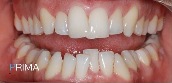 Ortodonzia Trasparente 5 Vena Odontoiatria - Brand Guidelines (1)
