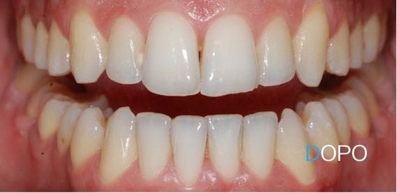 Ortodonzia Trasparente 6 Vena Odontoiatria - Brand Guidelines