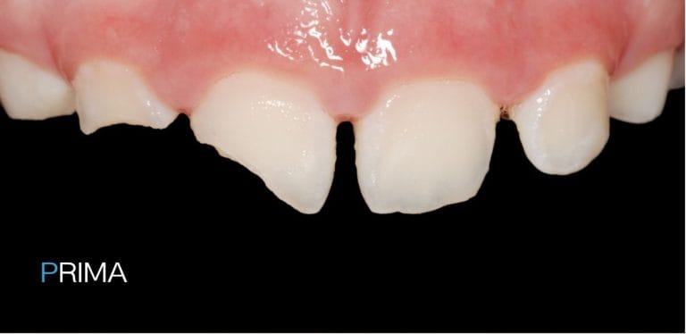 Pedodonzia 6 dentista per bambini a Terni