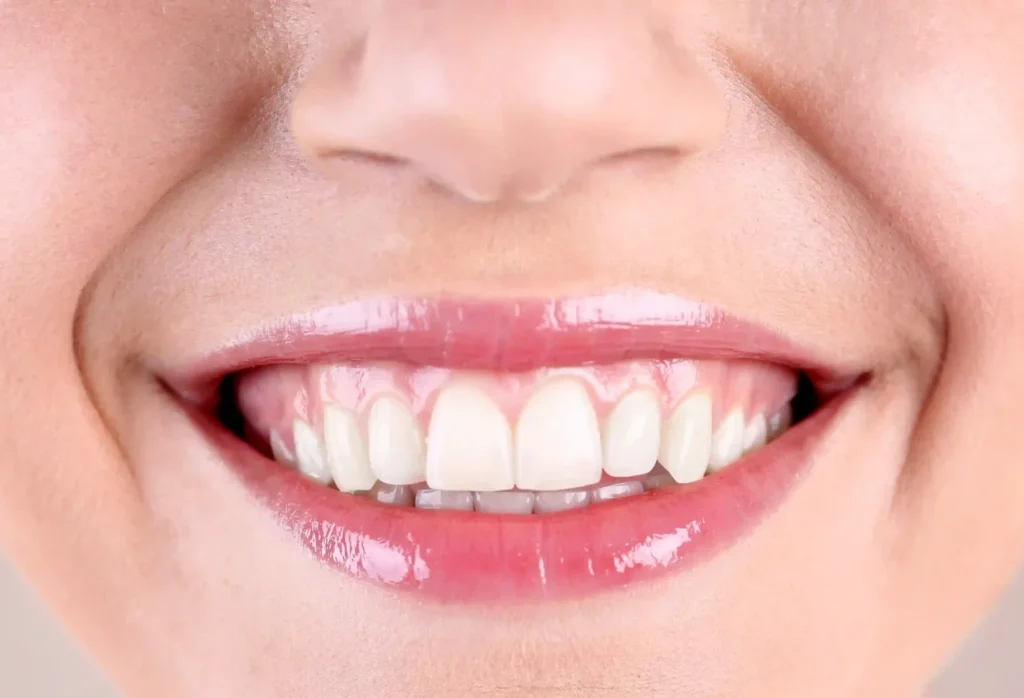 Medicina Estetica 3 close up of smiling woman showing perfect teeth 2026 03 05 11 28 39 utc scaled e1785330409323