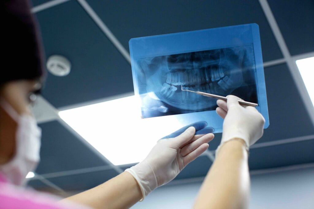 glossario implantologia dentale