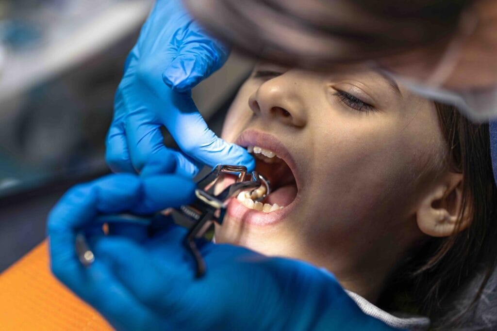 glossario odontoiatria pediatrica