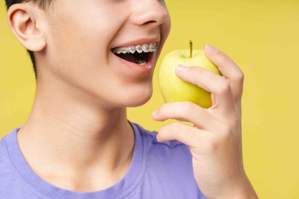 Cosa non mangiare mai con l’apparecchio fisso per evitare problemi e fastidi 1 Cosa non mangiare mai con l’apparecchio fisso