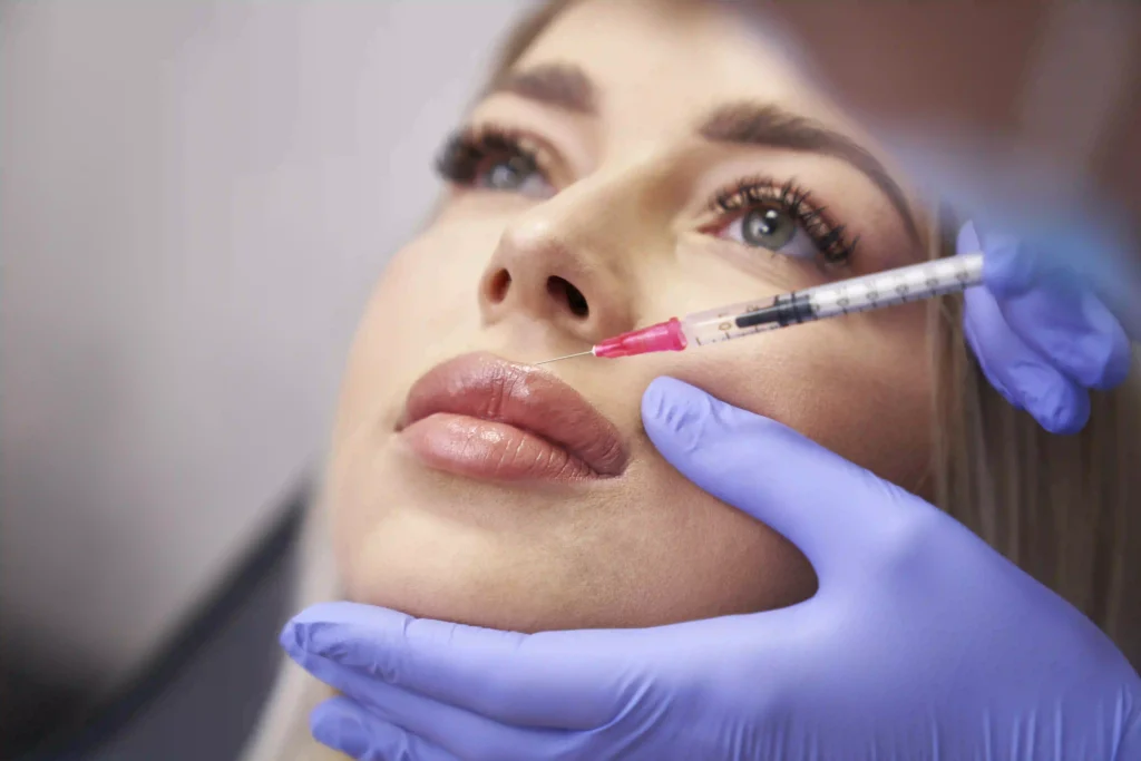 Medicina Estetica 2 Filler labbra a Terni